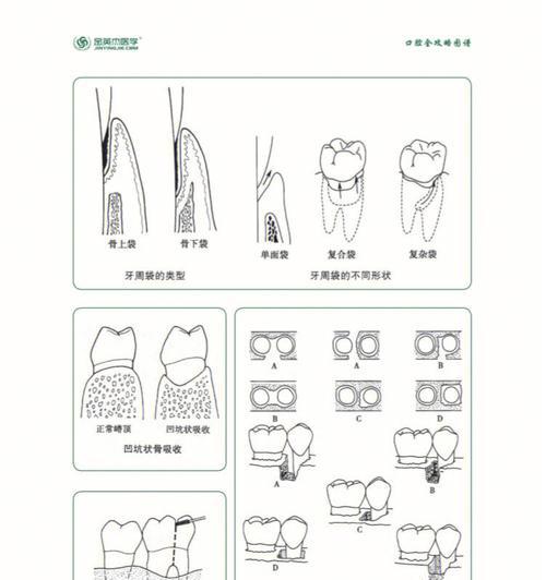 口腔执医技能备考攻略（有效准备口腔执医技能考试的关键方法与技巧）-第2张图片-游技攻略库